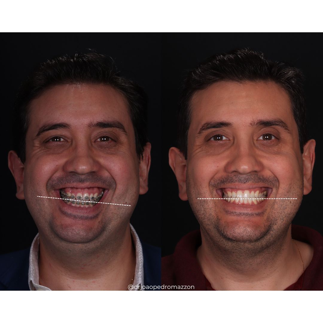 João Pedro Paulino Mazzon-33