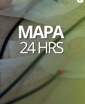 Exame M.a.p.a 24H-0