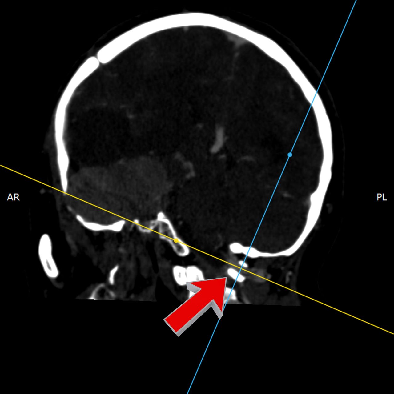 David Tafur Muñoz-2272