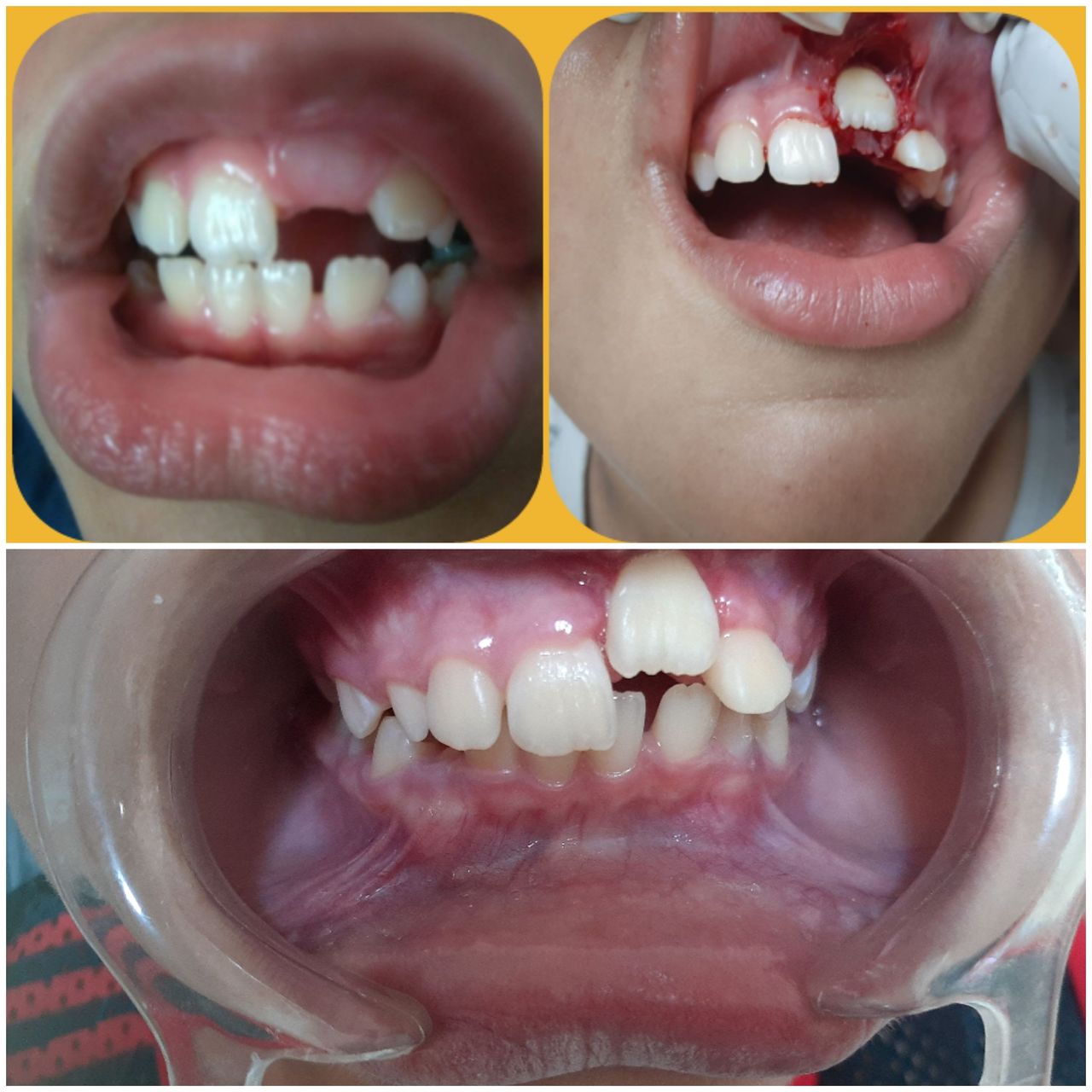 Alexandre Giannini-13