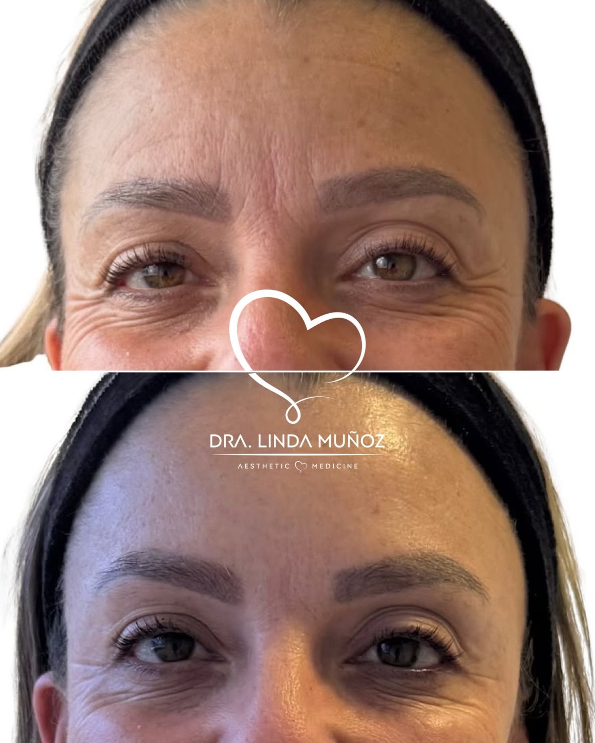 Linda Muñoz-44