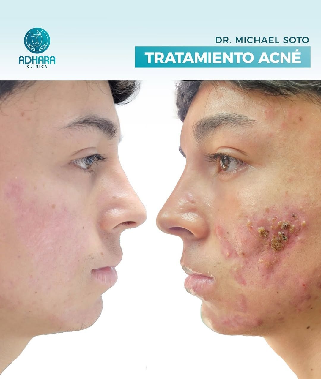 Michael O. Soto Belmar-5