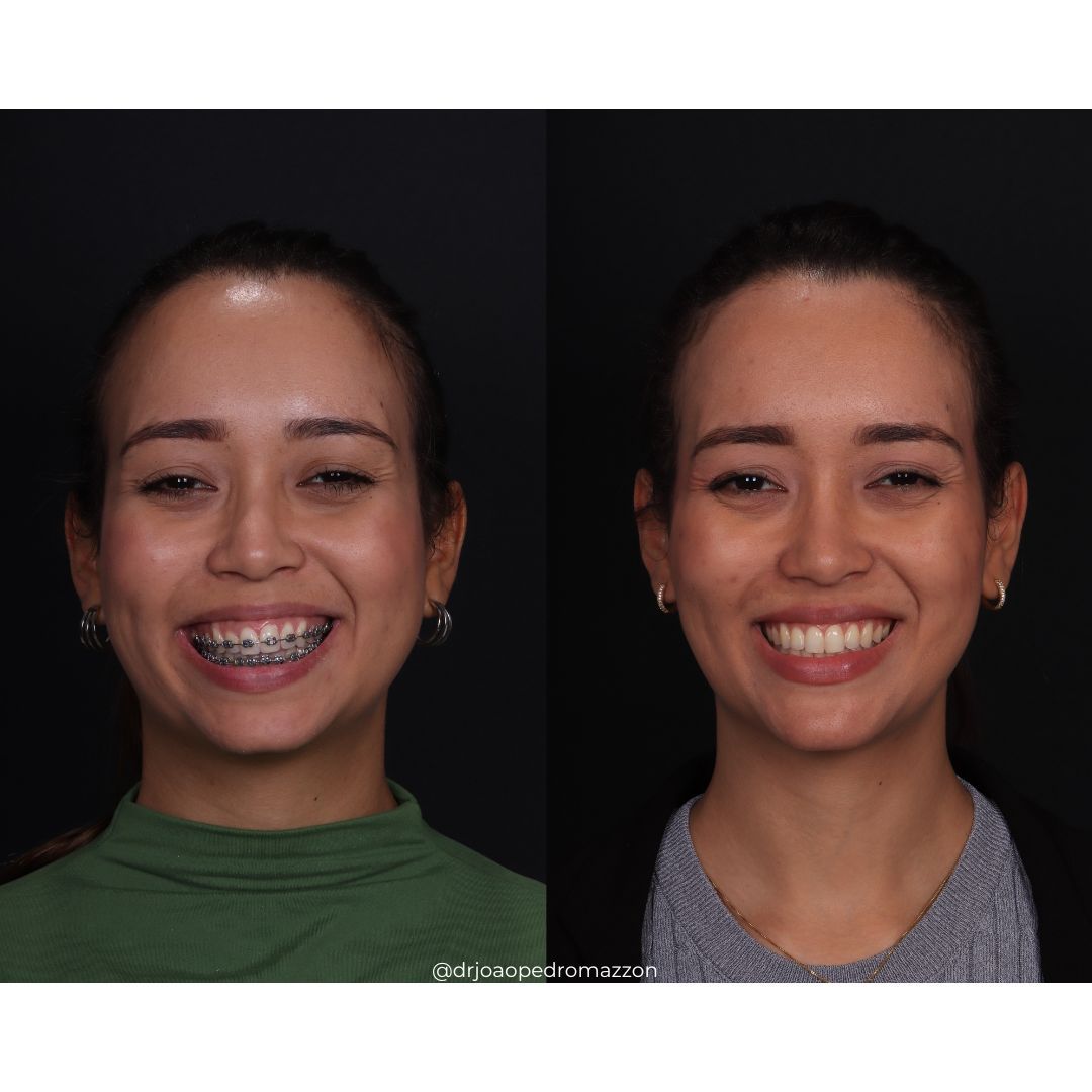 João Pedro Paulino Mazzon-36