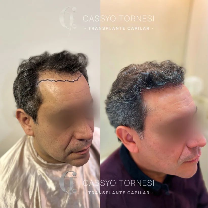 Cassyo Tornesi-22