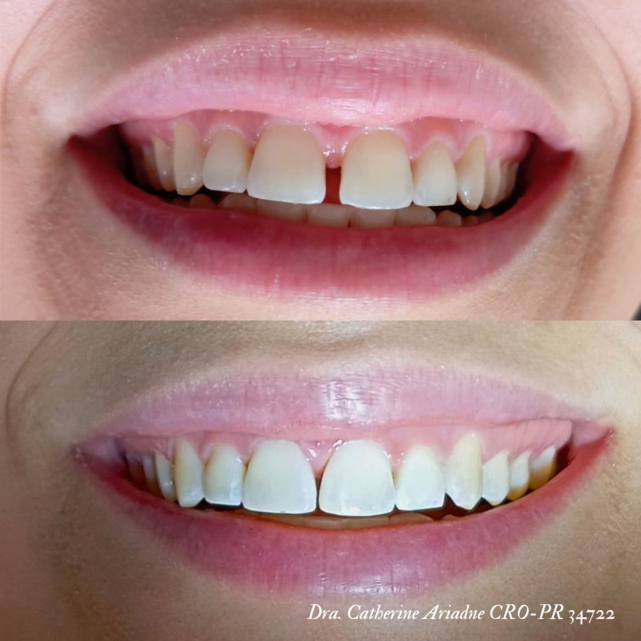 Catherine Ariadne De França  Valente-6