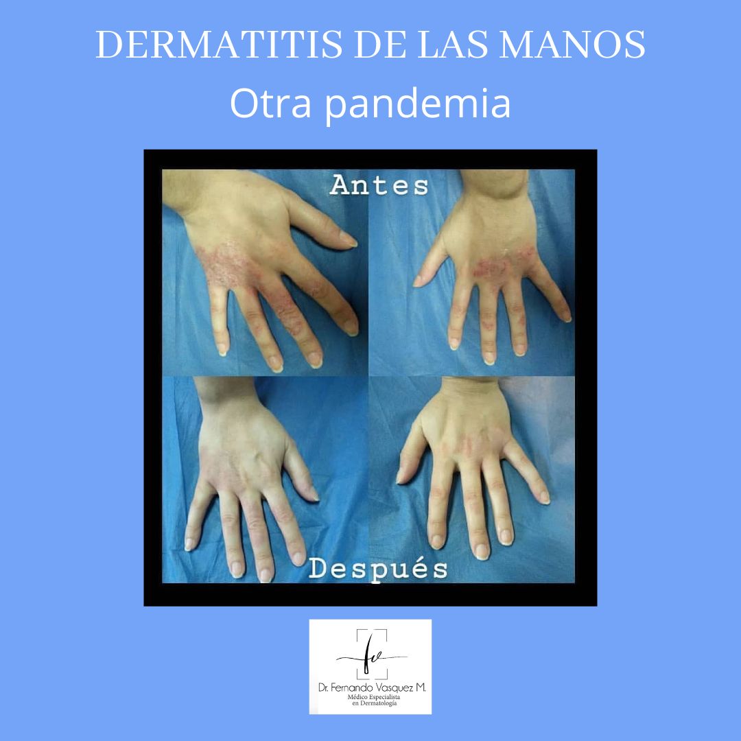 Fernando Vasquez Maldonado-10