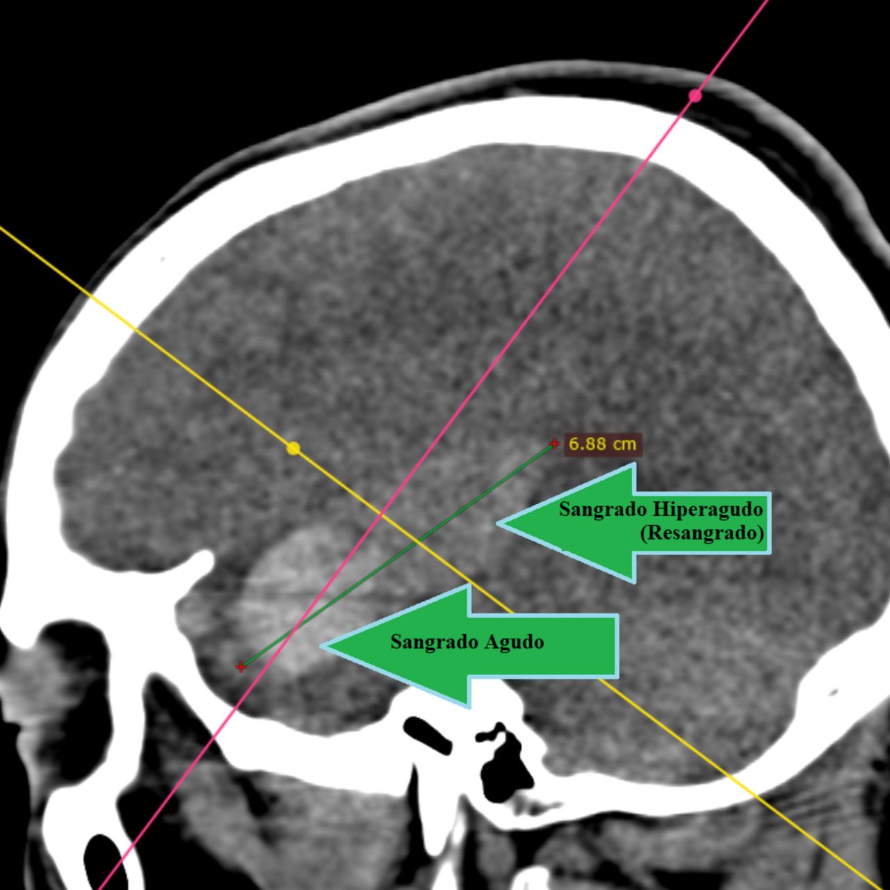David Tafur Muñoz-1516