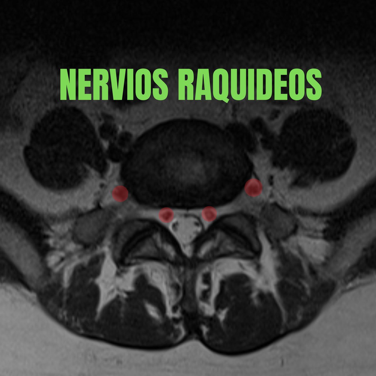 David Tafur Muñoz-2230