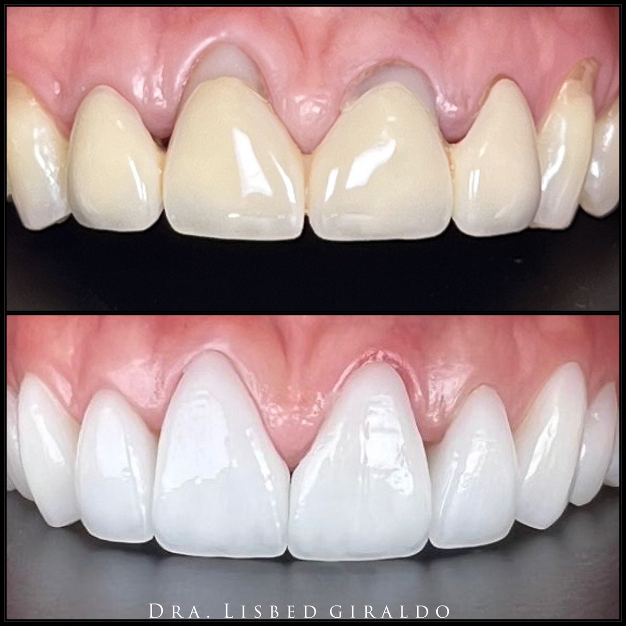 Lisbed Giraldo Olarte-18