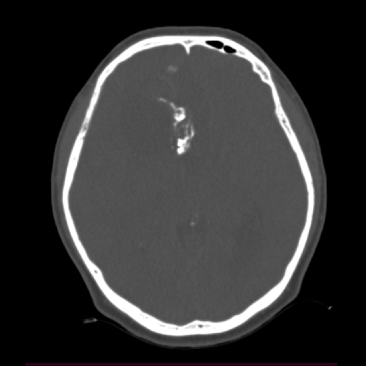 David Tafur Muñoz-2235