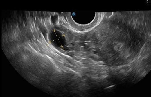 Arisev Maria Figueroa Ramos-7