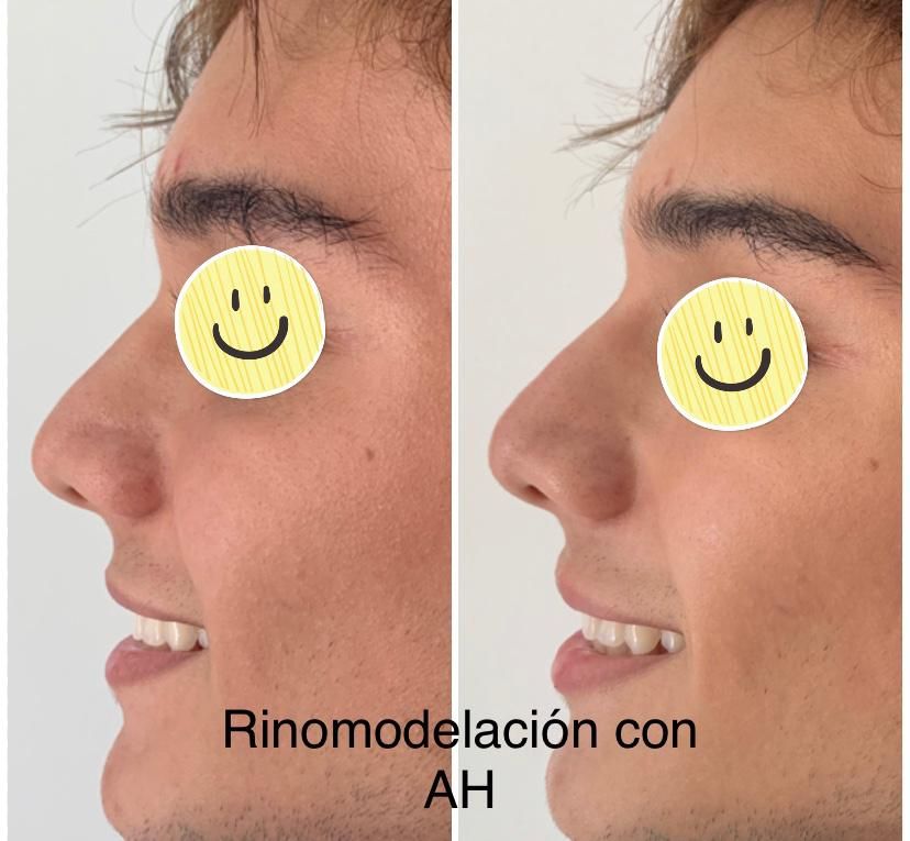 Maria Gisela Angel Losada-41