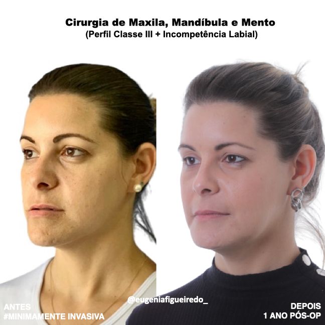 Eugênia Figueiredo-29