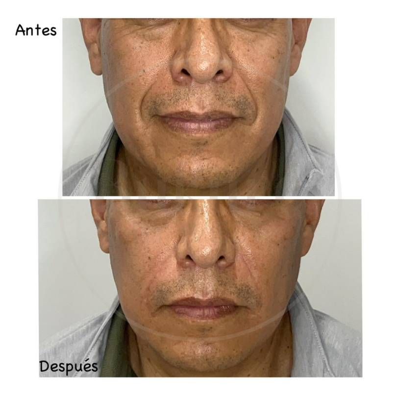 Oscar Iván Lozano Navarrete-10