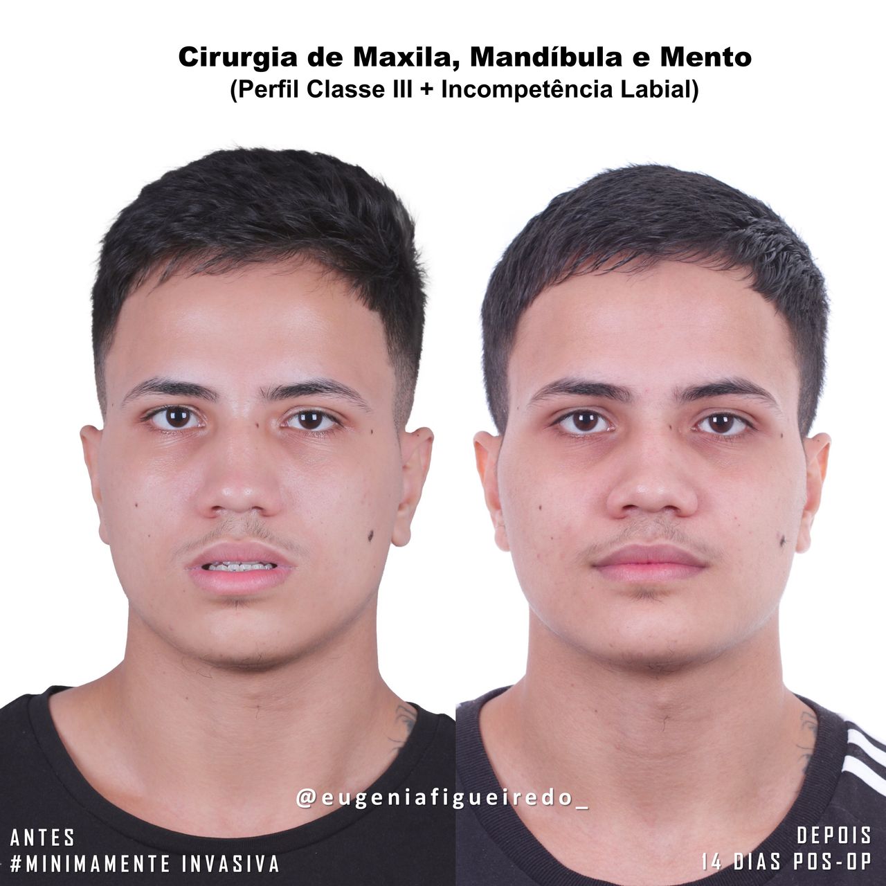 Eugênia Figueiredo-5