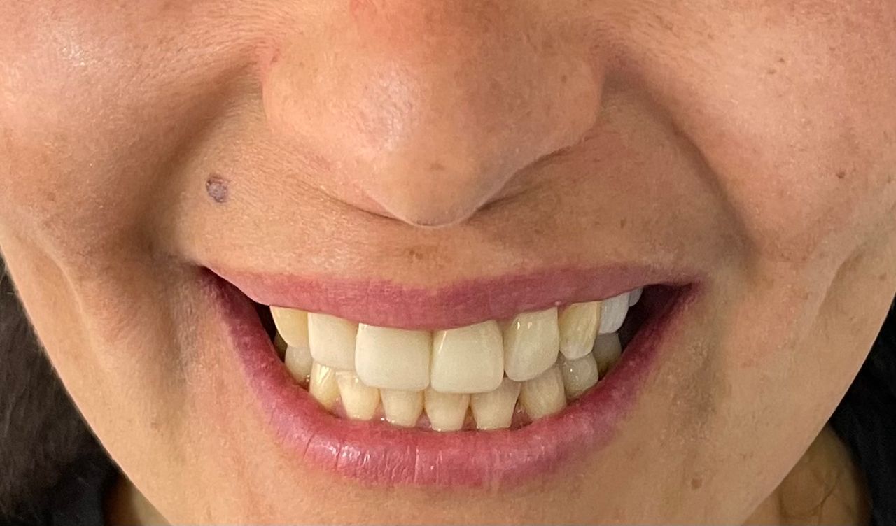 Luciano Varas Salinas-32