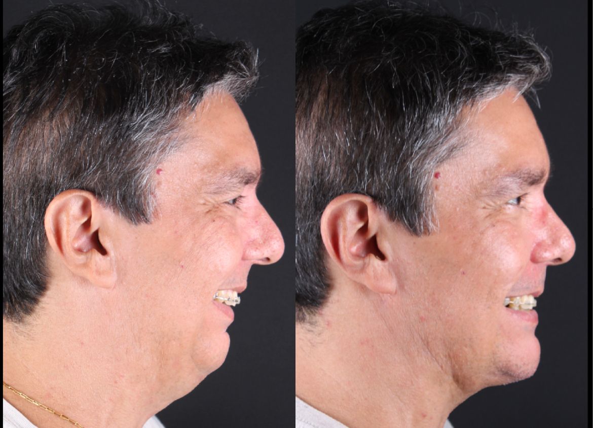 Frederico Carnevale-10