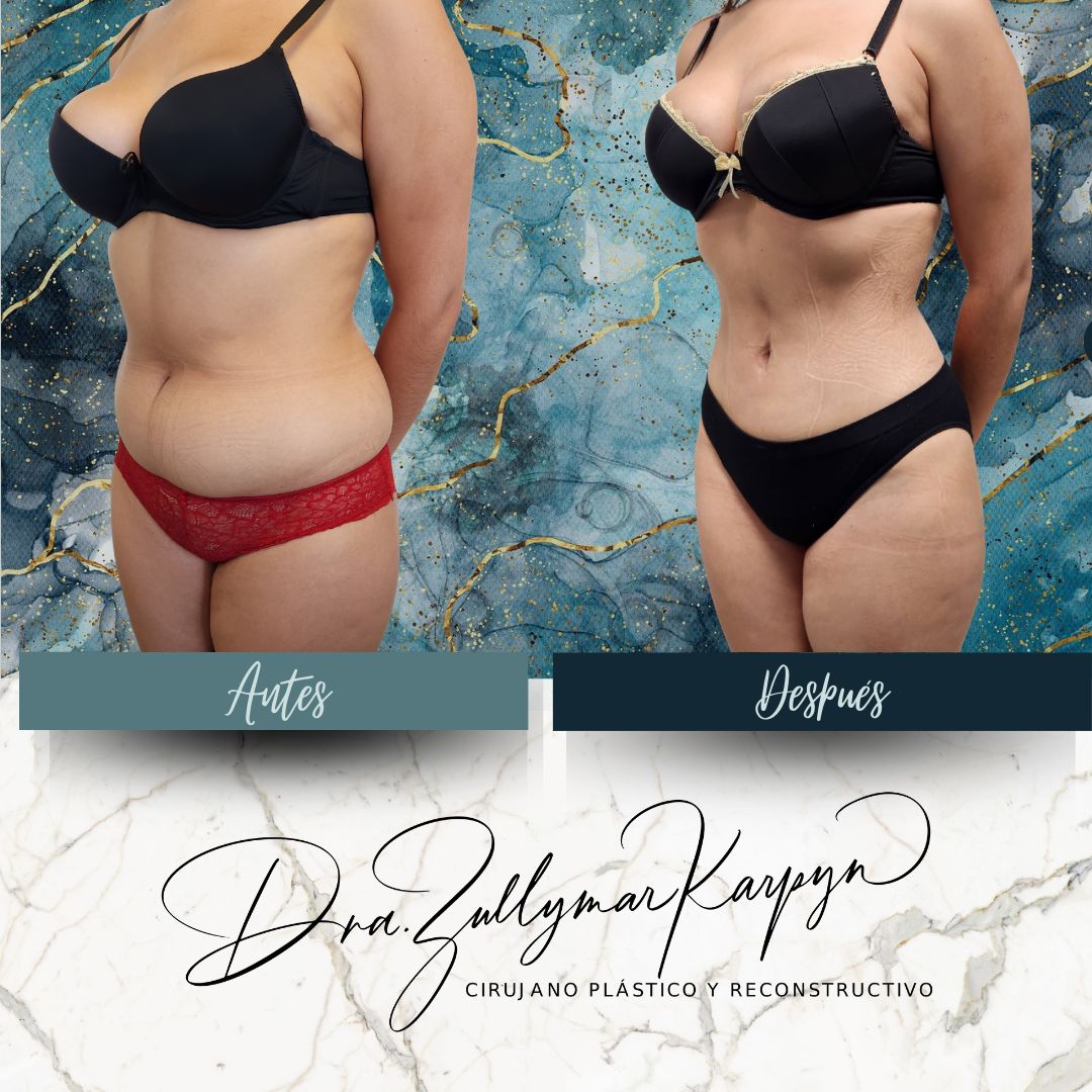 Zullymar Karpyn Brito-10