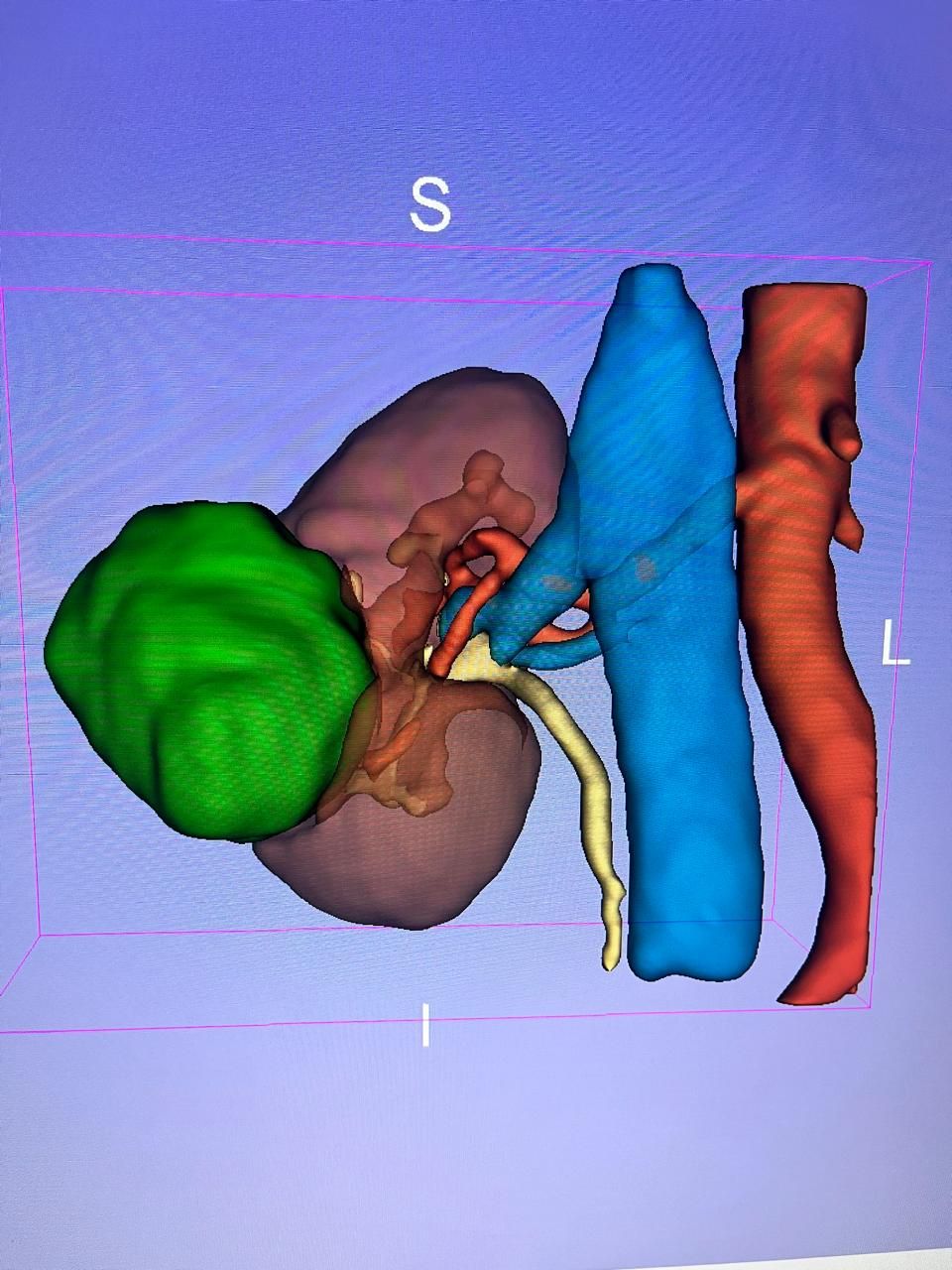 Yves Melo Rodrigues Martins-5