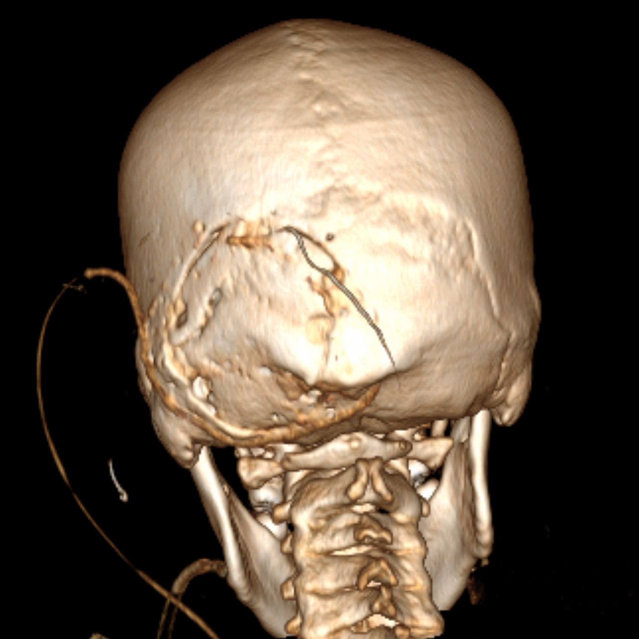 David Tafur Muñoz-1225