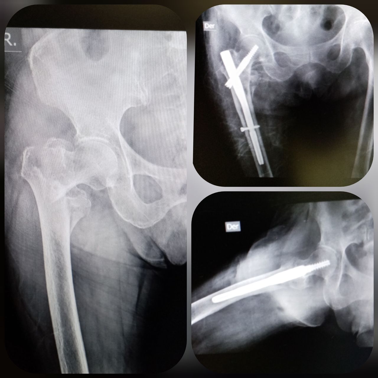 Carlos Escalante Saavedra-21