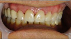 Jhoan Felipe León Correa-5