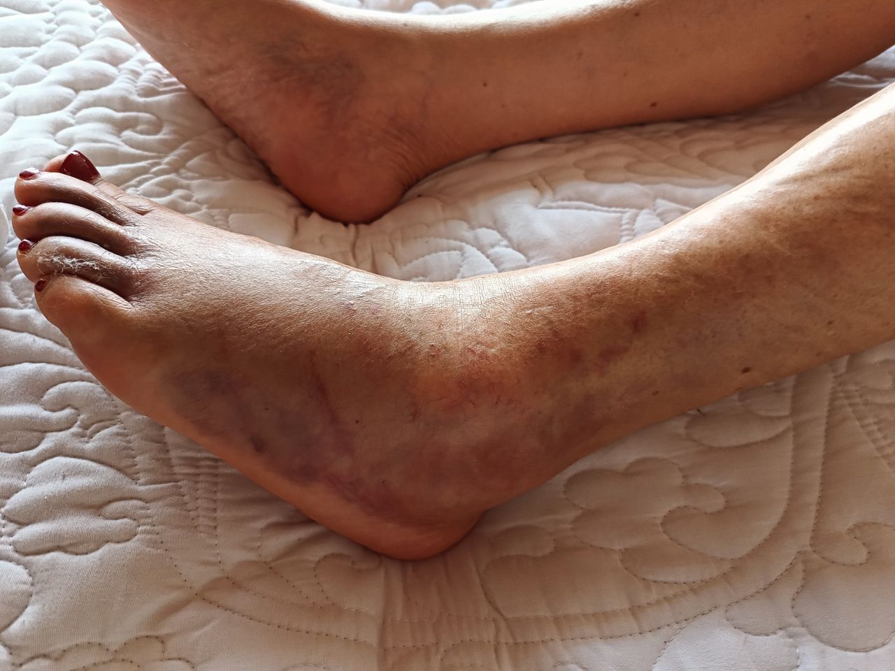 Luz Angela Murcia Camargo-5