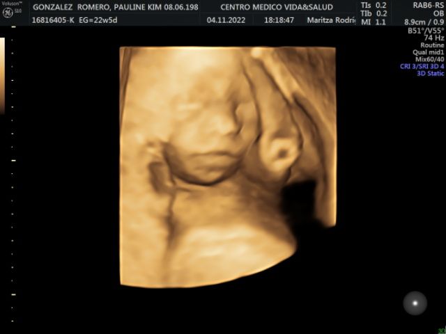 Maritza Rodriguez Balanta-15