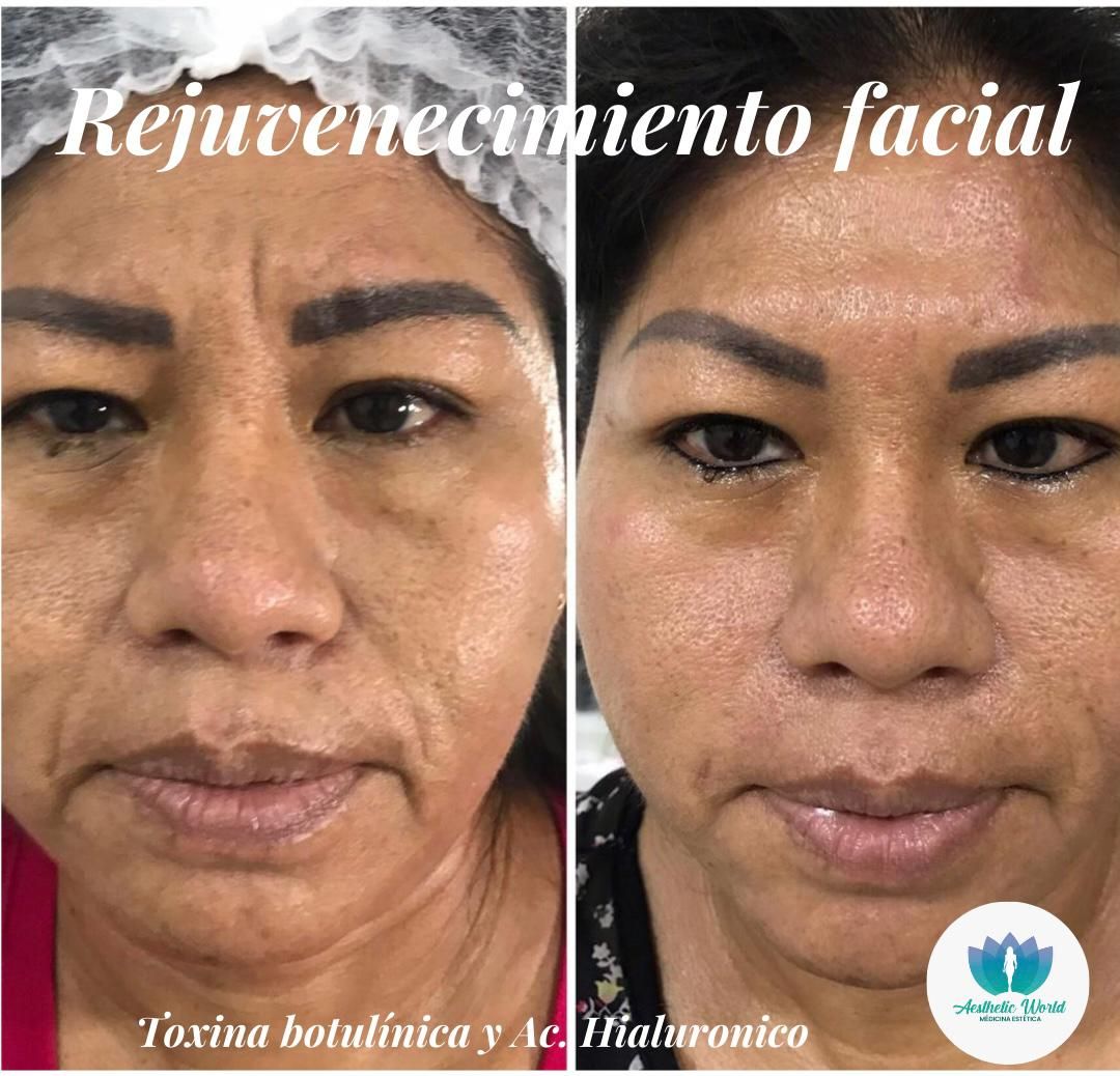 Jhonatan Oyola Farfán-16