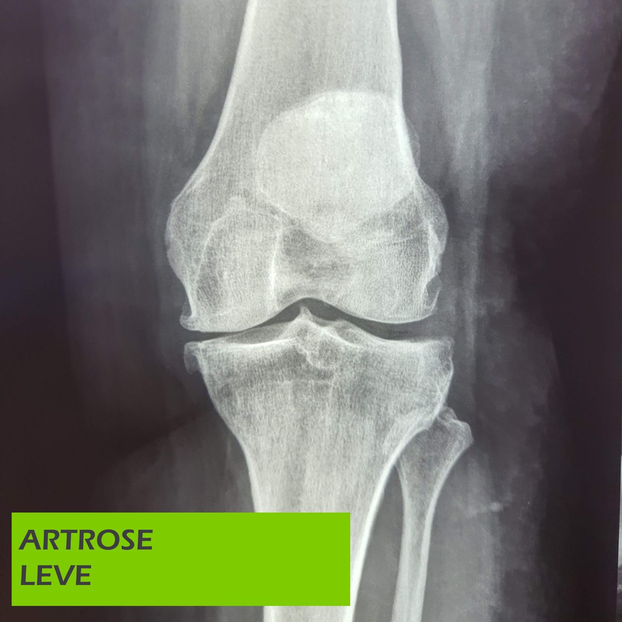 Paulo Roberto Capelletti-34