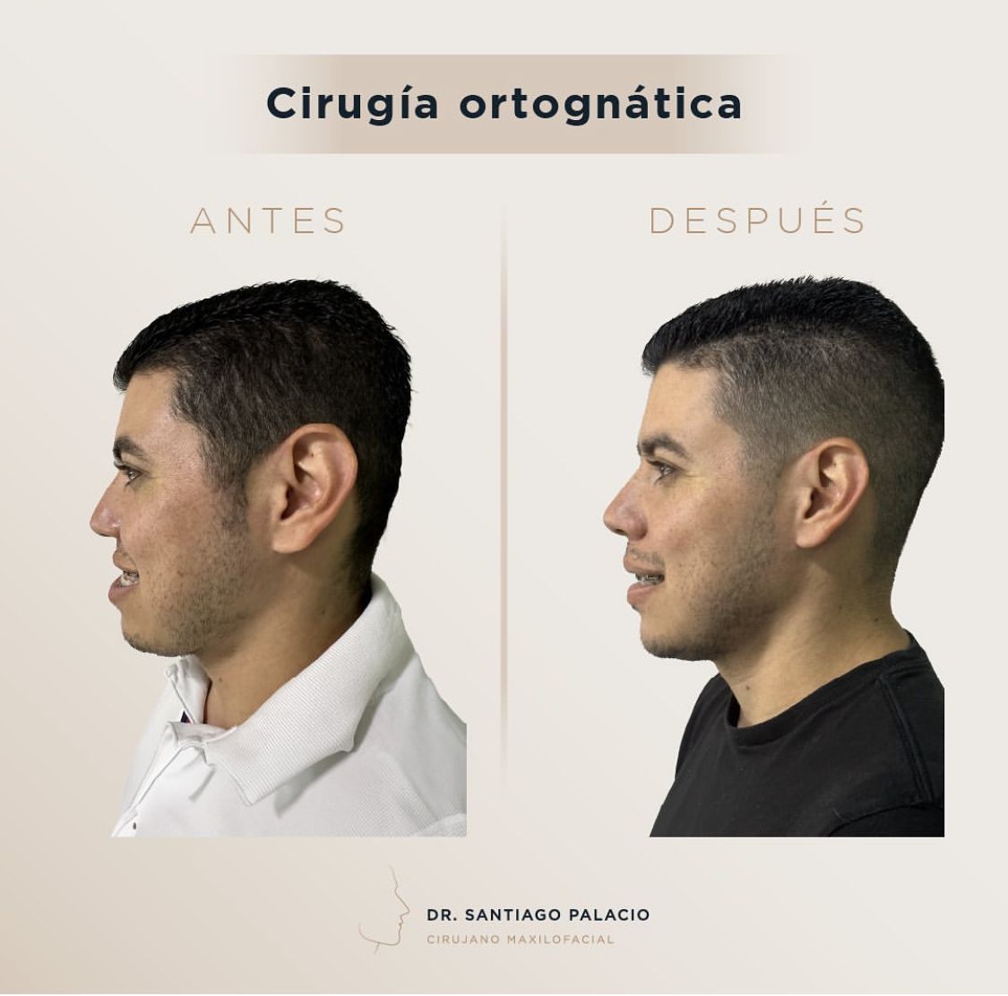 Santiago Palacio Gutierrez-3