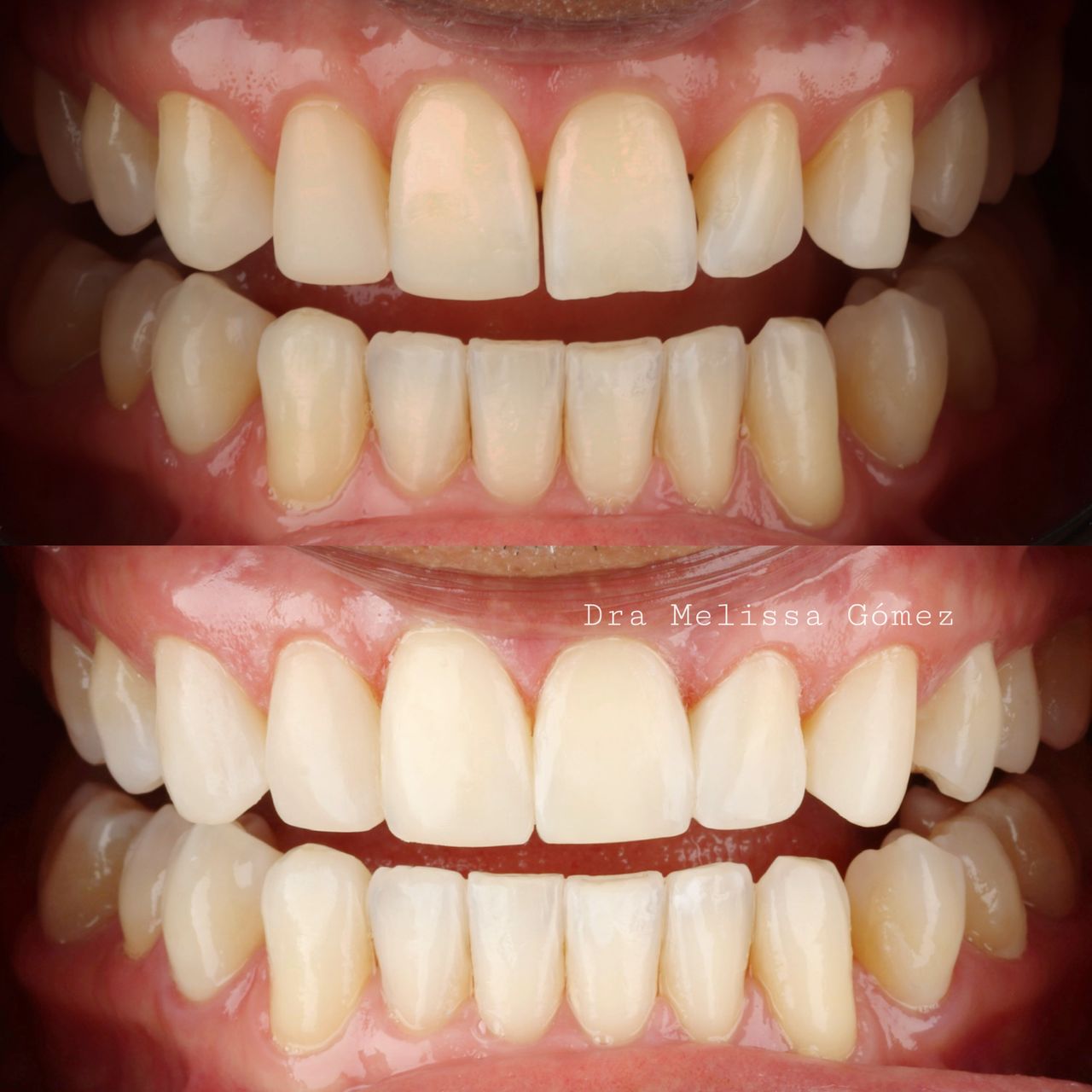 Melissa Gómez Arango-5