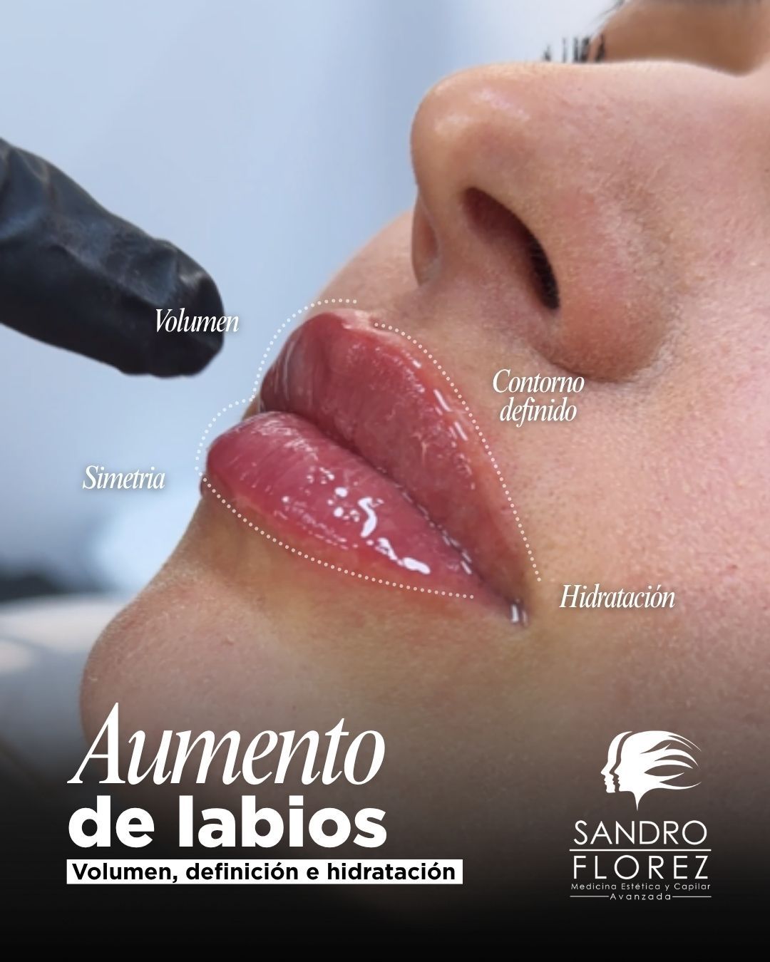 Sandro Florez-9