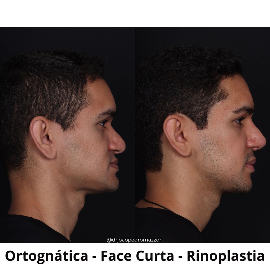 João Pedro Paulino Mazzon-14