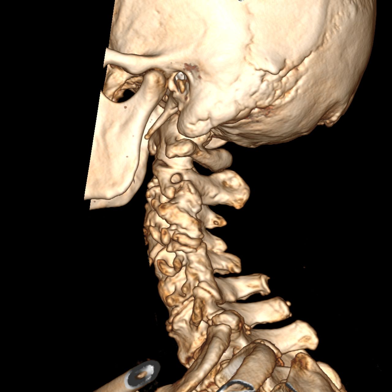 David Tafur Muñoz-1187