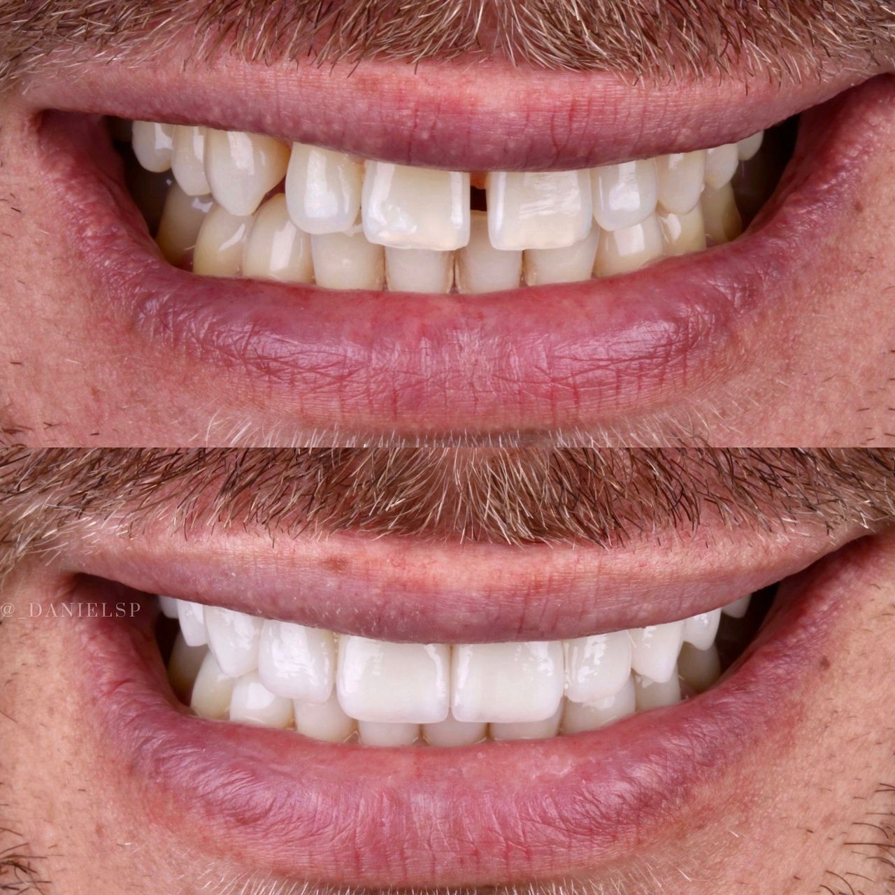 Daniel De Souza Pereira-25