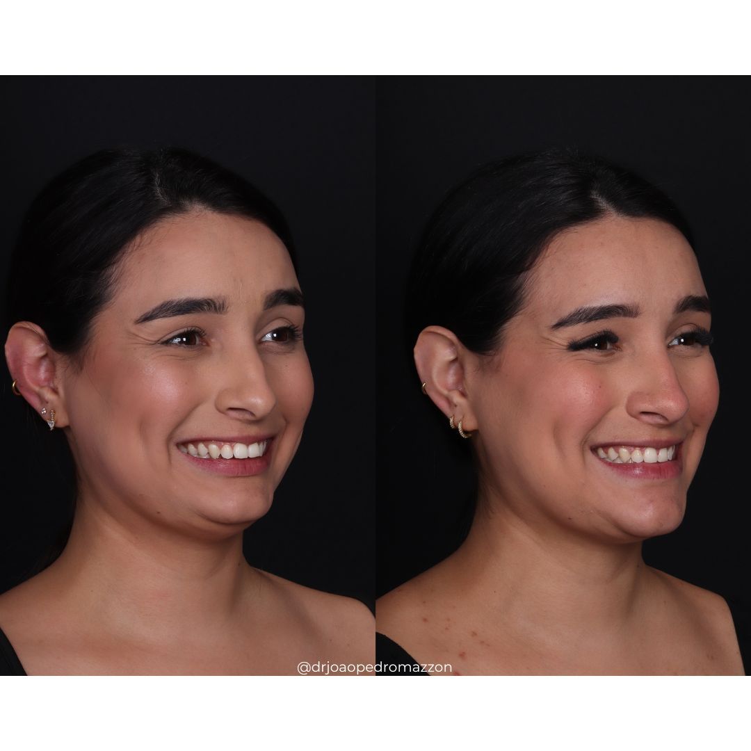 João Pedro Paulino Mazzon-3