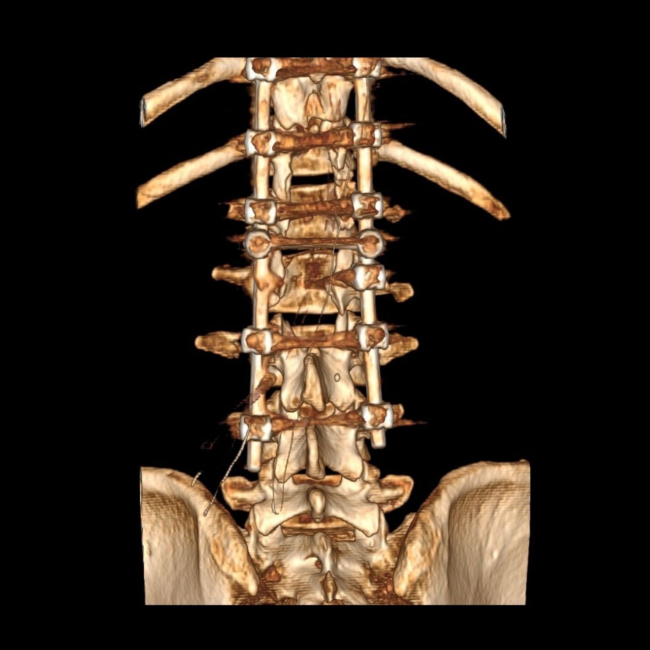 David Tafur Muñoz-1289