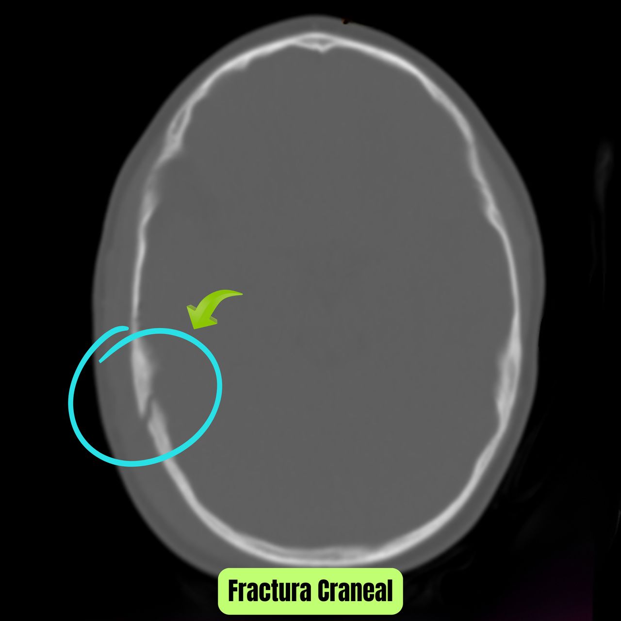 David Tafur Muñoz-2275