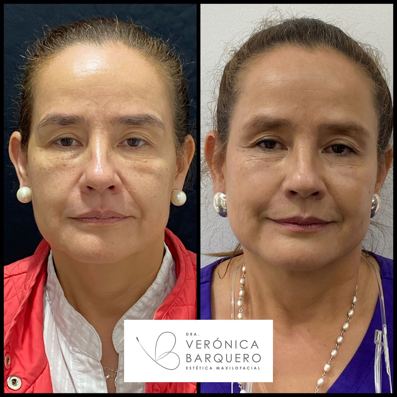 Veronica Maria Barquero Figueroa-24