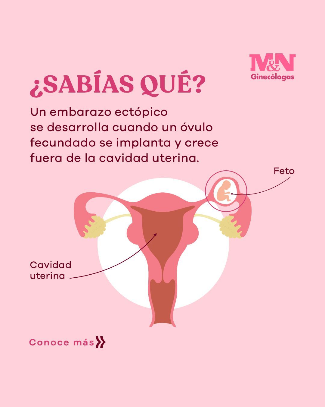 Mariella Gonzales Bolarte-20