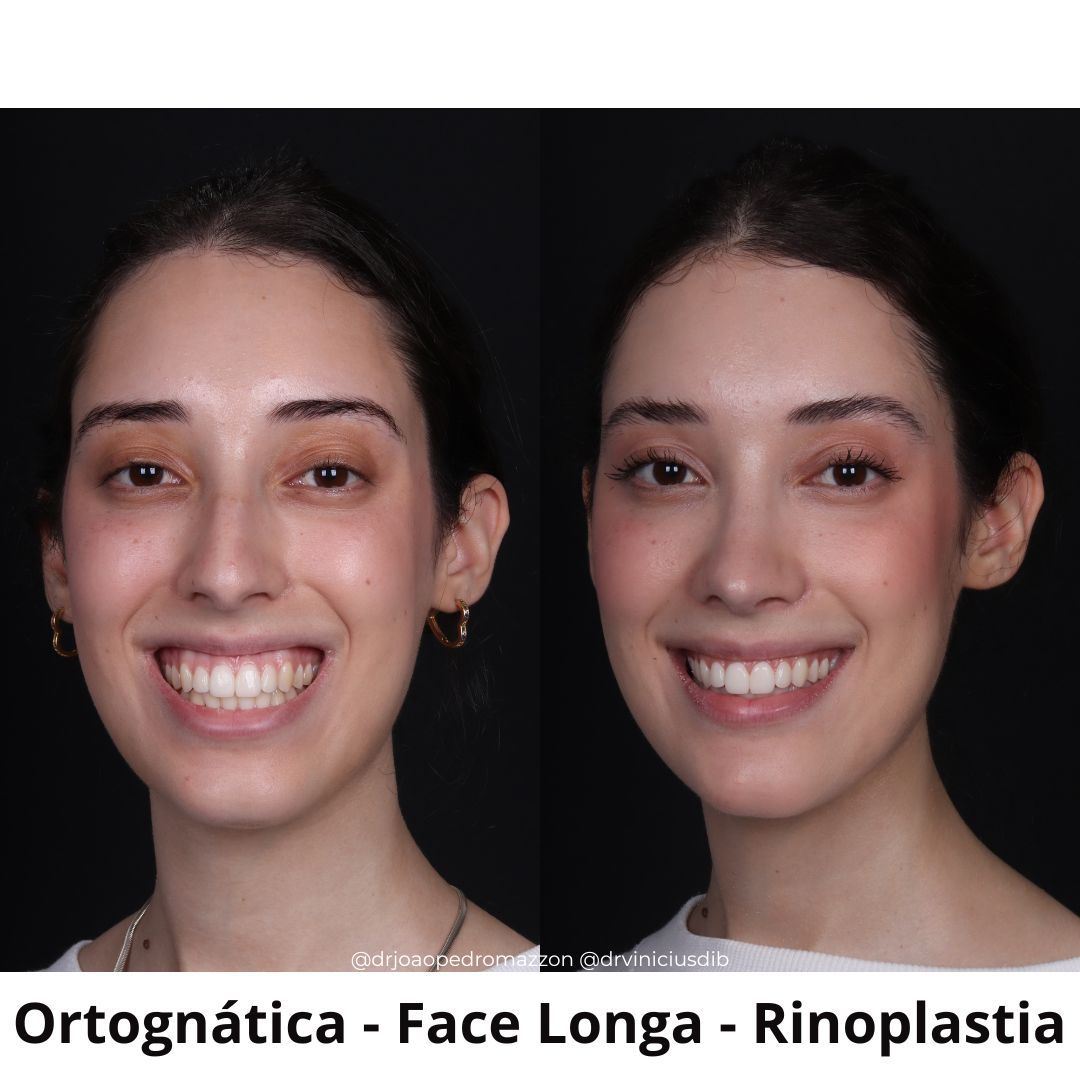 João Pedro Paulino Mazzon-11