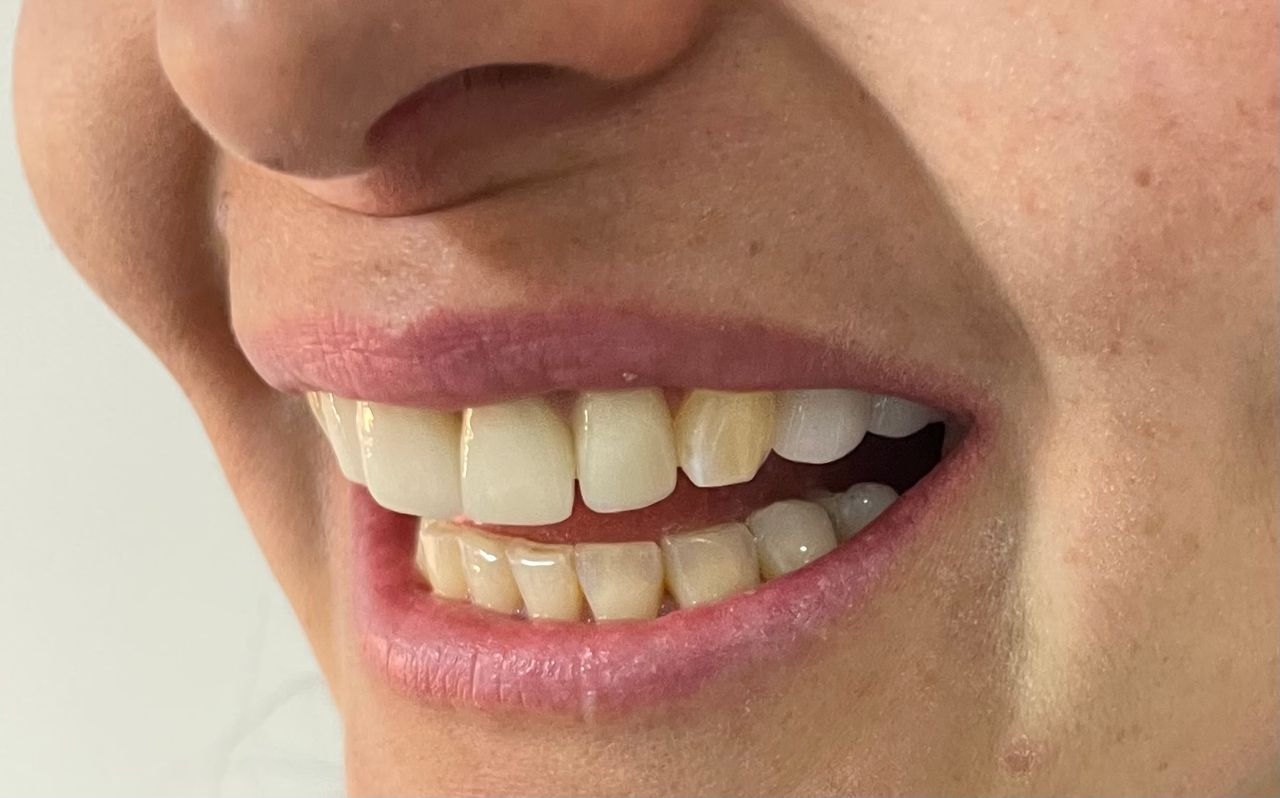 Luciano Varas Salinas-33