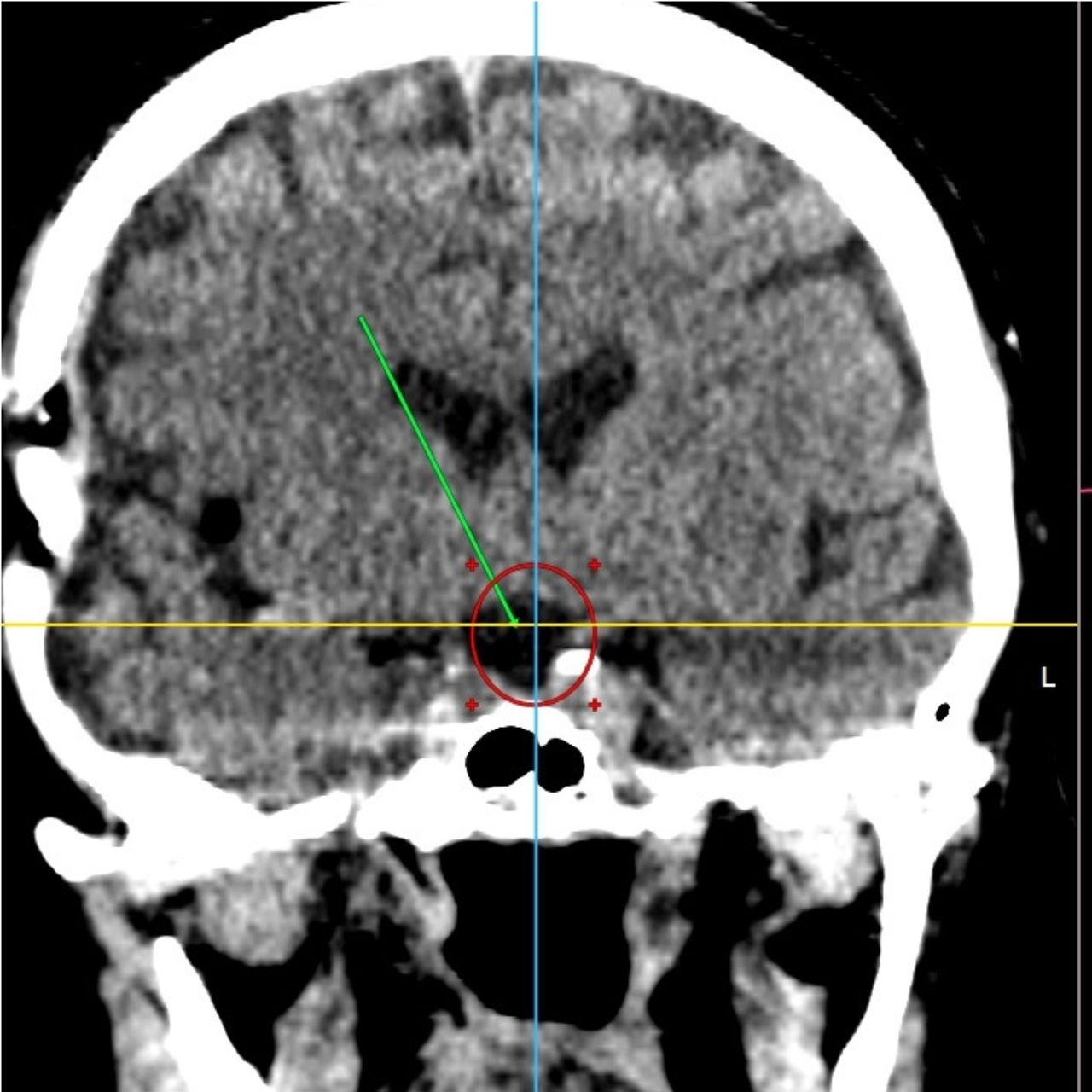 David Tafur Muñoz-1398