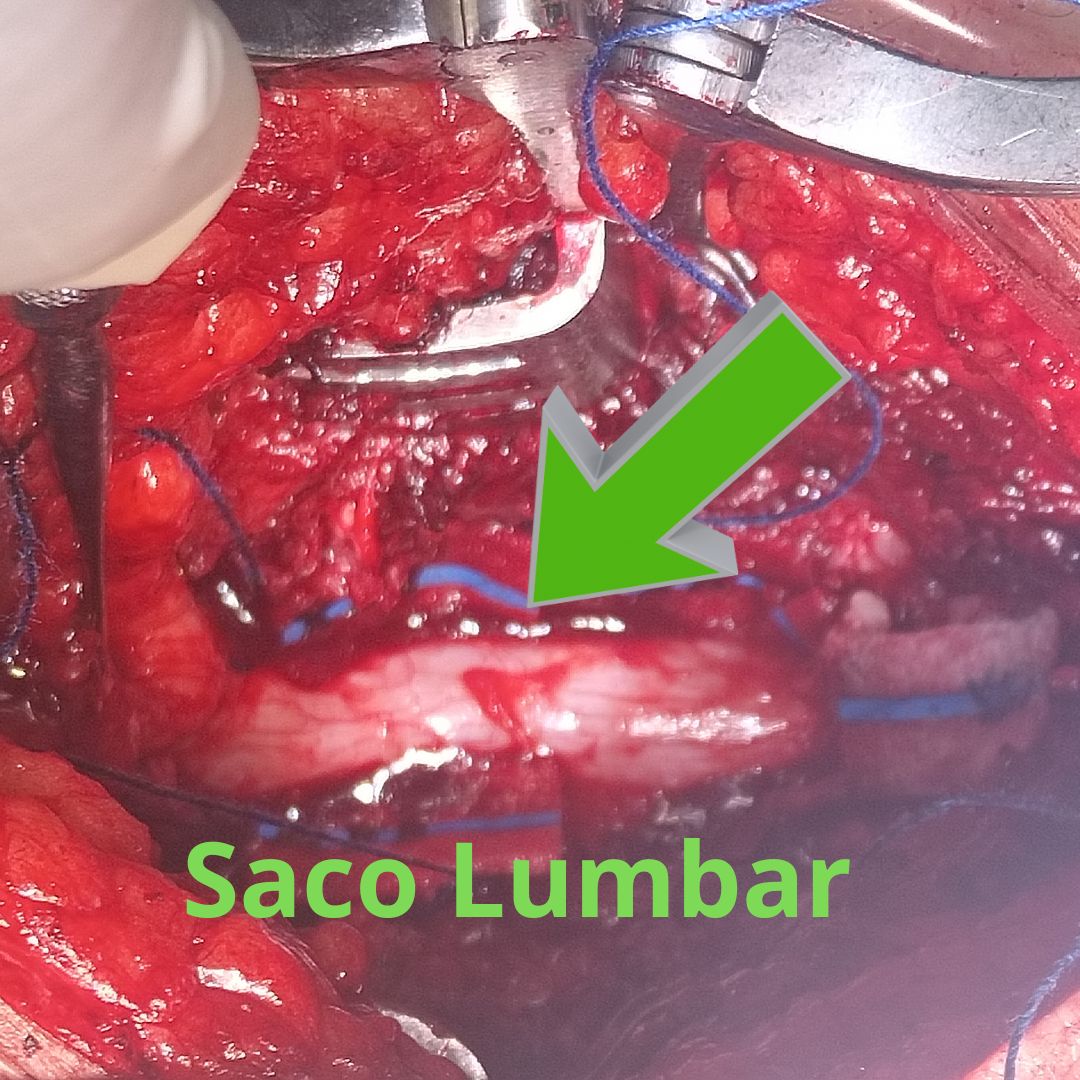 David Tafur Muñoz-2066