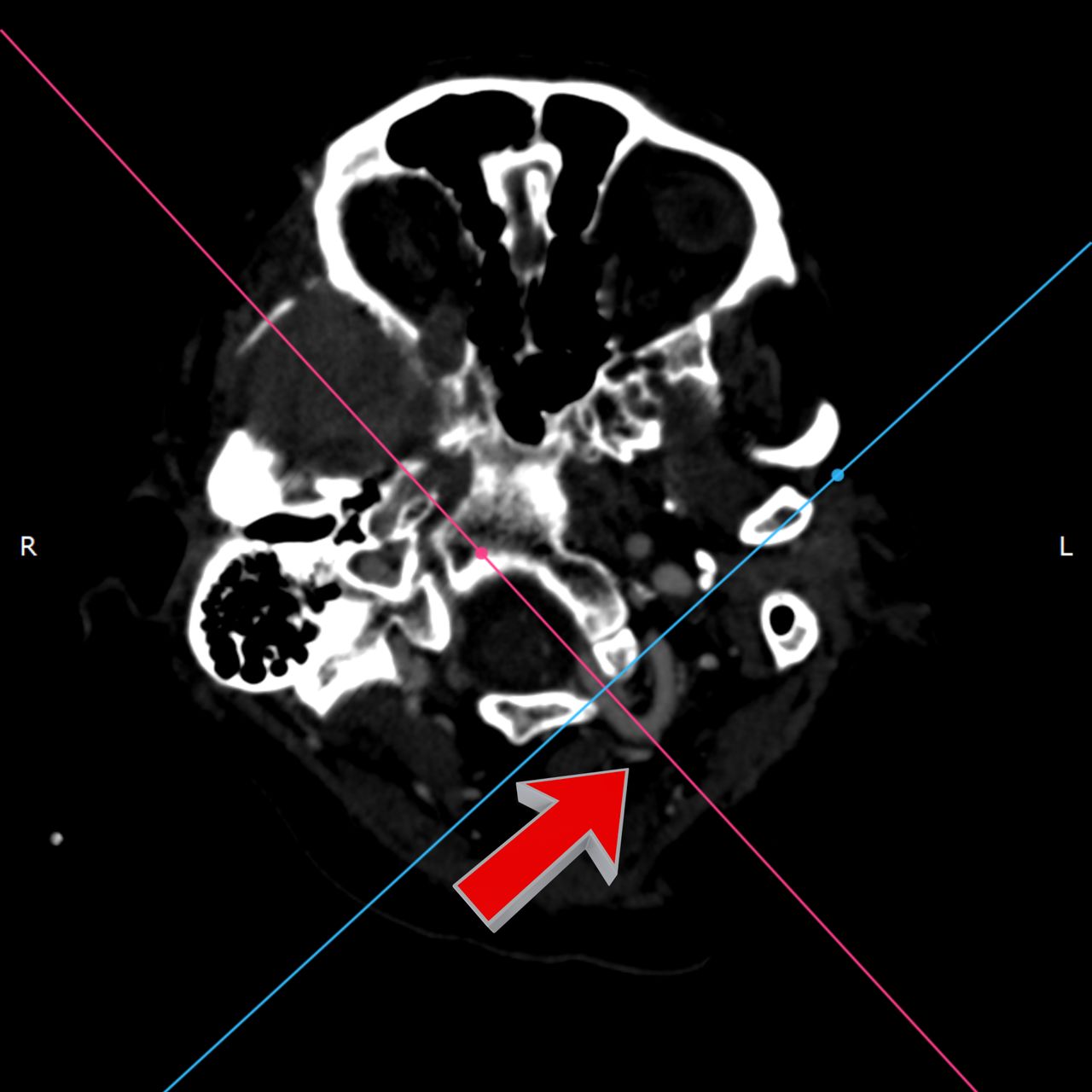 David Tafur Muñoz-2273