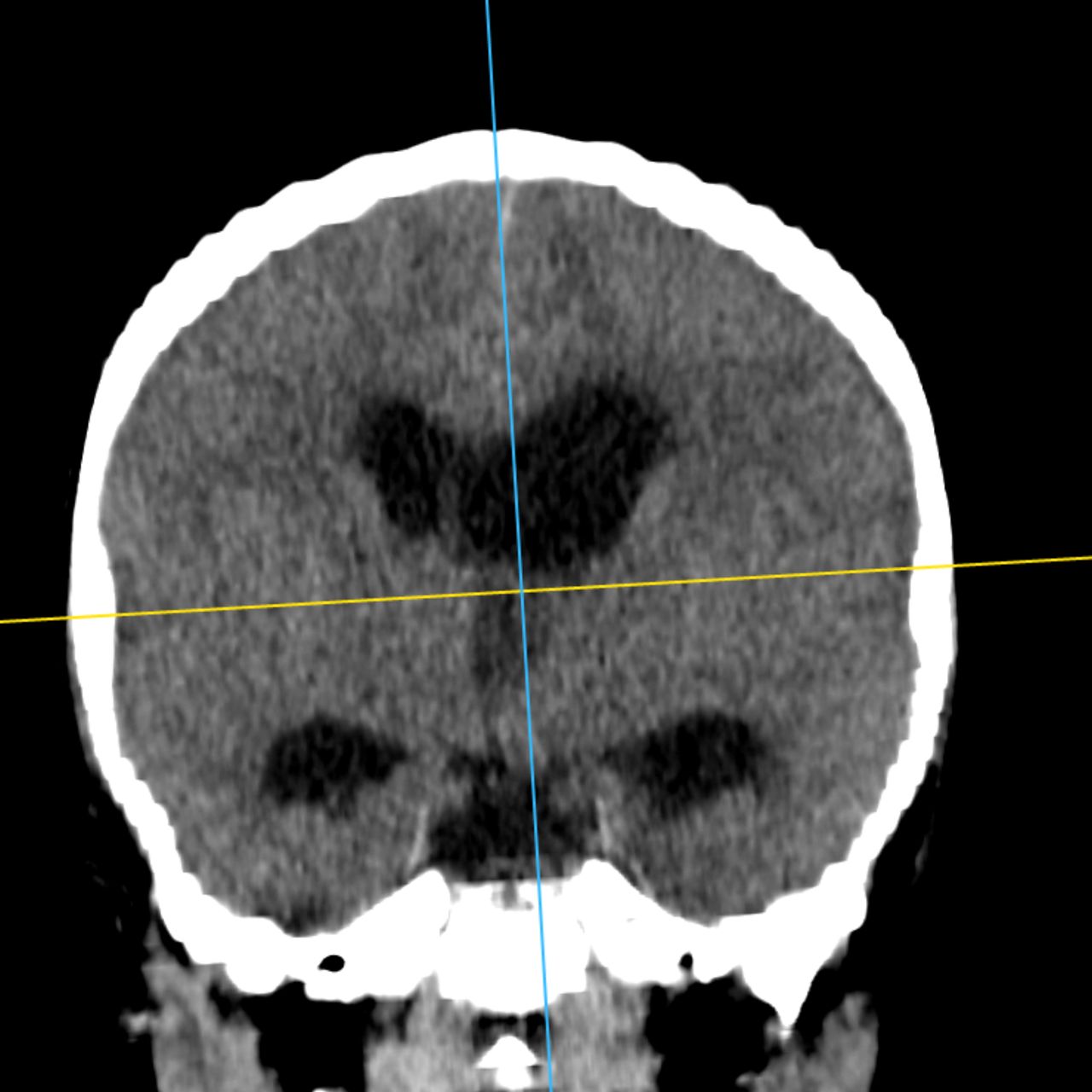 David Tafur Muñoz-2010