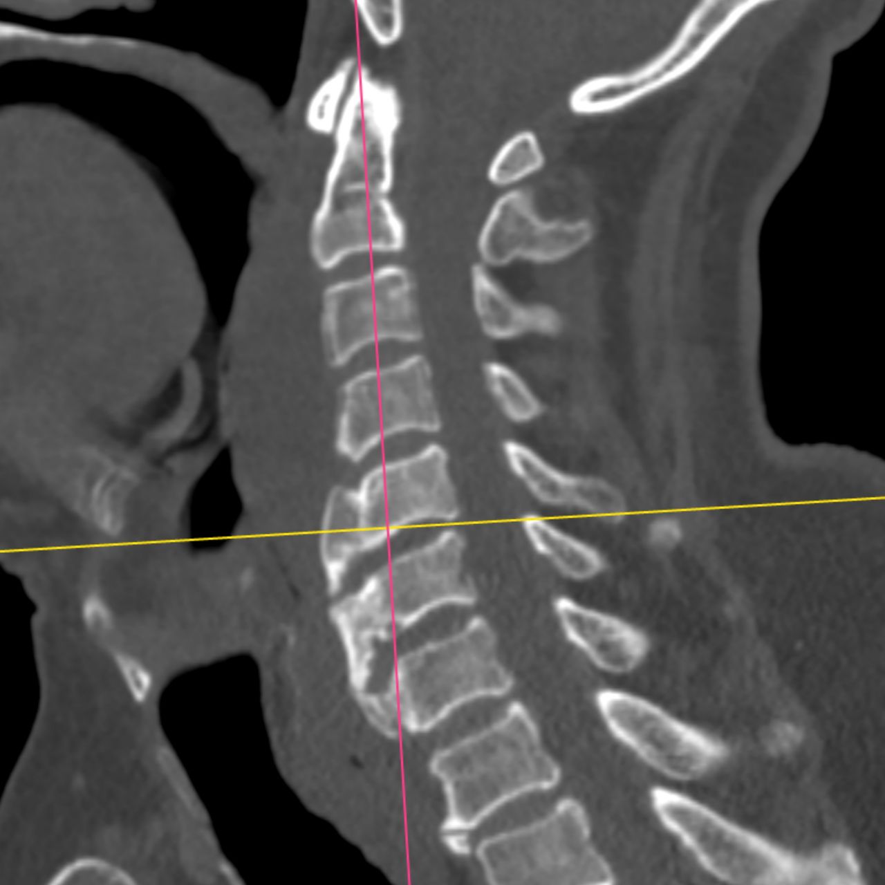 David Tafur Muñoz-2413