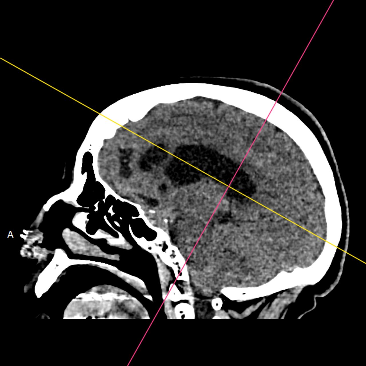 David Tafur Muñoz-1806