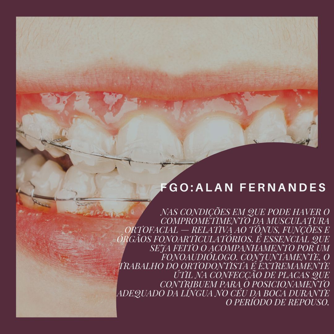 Alan Fernandes-8